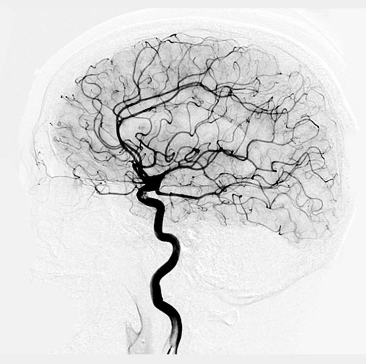 Дженнифер Энистон, нобелевка и "бабушкины нейроны"